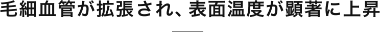 毛細血管が拡張され、表面温度が顕著に上昇